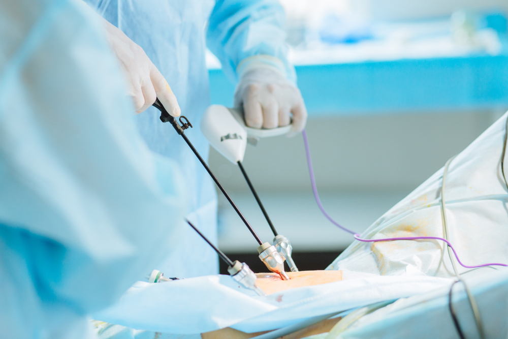 Laparoscopy Cost in Kazakhstan With Procedure, and Benefits in 2024