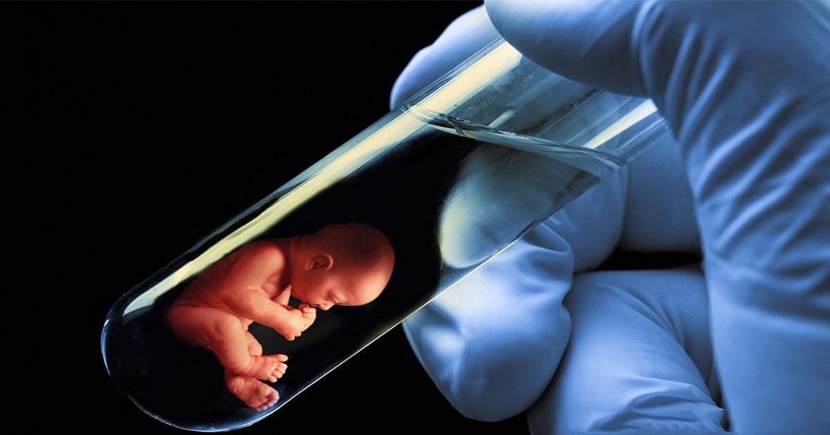 Test Tube Baby Cost in Kenya