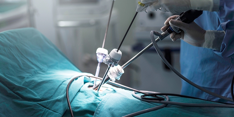 Laparoscopy Cost in Kenya